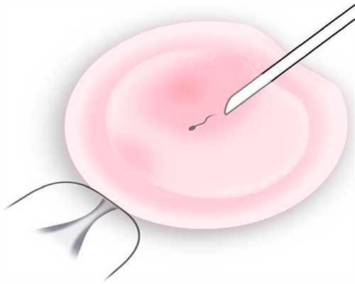 广安试管代孕-广安做代孕的母亲-广安代孕产子中介公司