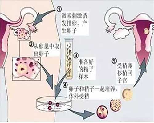 上海代孕~上海代怀小孩哪里有~上海代孕医院包成功多少钱