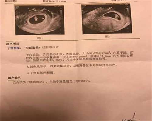 深圳助孕包性别电话，试管婴儿移植后出血怎么应对？