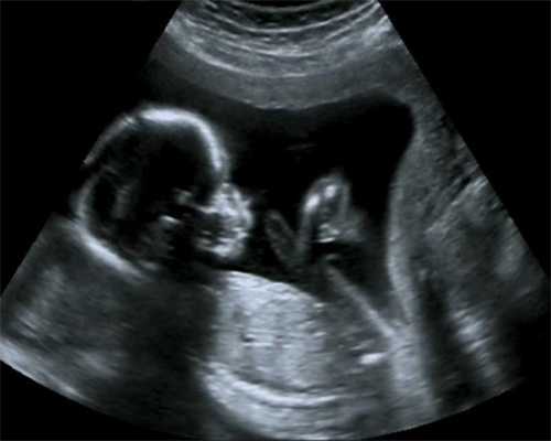 郑州代怀代生宝宝，哺乳妈妈应该怎样避孕？