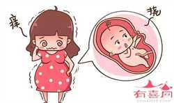 郑州代生子包成功，婴儿肛瘘的症状有哪些呢