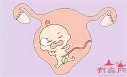 郑州供卵自怀~郑州借卵生子价格~郑州供卵试管婴儿中介，有吃林卡尔却生女孩